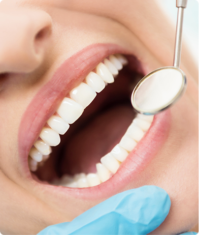 Full Mouth Reconstruction near me - Full Mouth Reconstruction Dentist - Dr. Del Puerto - Smiles at Doral - dentist near me - dentist Doral FL - cosmetic dentistry - restorative dentistry - cosmetic dentist near me - dentist office near me 