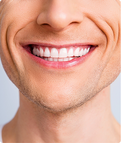 Restorative Dentistry Doral, FL - Dr. Belkis C. Del Puerto - Smiles at Doral - dentist near me